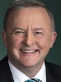 Anthony Albanese